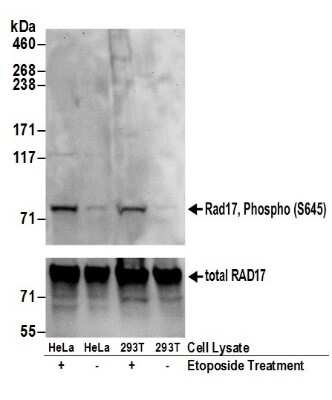 Western Blot: Rad17 [p Ser645] Antibody [NB100-273]